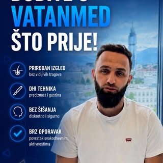 Najljepši dio našeg posla su ovakvi susreti.

Godinu dana nakon transplantacije kose, Mersid je pono