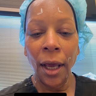 Turning 65 is a special time in your life when you seriously think about adding aesthetic procedures