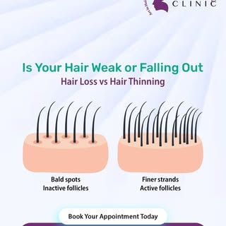 Hair thinning ≠ Hair loss 🚫

Seeing more hair on your pillow but no bald spots yet?

That’s hair th