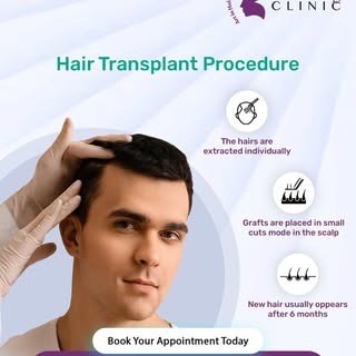 Permanent Hair Restoration Starts Here.

What if hair loss wasn’t permanent anymore?

A hair transpl