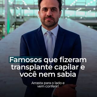 O transplante capilar tornou-se o procedimento queridinho dos famosos que não abrem mão de uma image