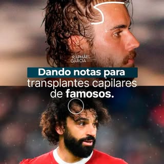 Nem sempre, só porque é famoso, significa que foi aplicada a melhor técnica ou a abordagem ideal no 