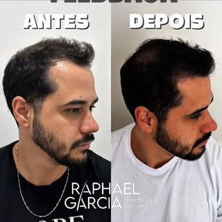 Sete meses de evolução e o resultado já fala por si. Ainda não chegamos ao resultado final, mas a sa