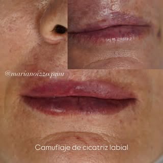 La micropigmentación no se trata solo de aportar color.

Se trata de crear una estructura de pigment