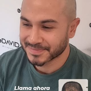 Quieres un cambio así? Tan real ante tus ojos como tu propio cabello. 
Solicita ya tu valoración y a