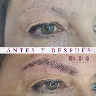 Cuando una enfermedad cambia tu rostro, no solo pierdes pelo en la ceja… también se va un pedacito d