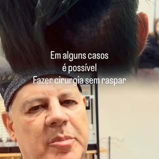 Somente em casos onde temos tres grandes qualidades eu recomendo a cirurgia sem raspar!
1- Boa área 