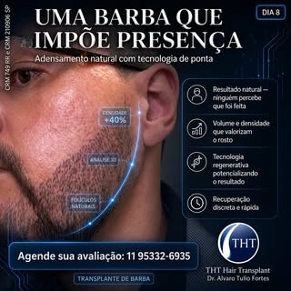 Uma barba mais densa muda completamente a presença e a harmonia do rosto. 👨🦱
Com o transplante de 