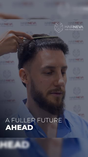 A Real HairNeva Experience 🦁

A personal perspective on the hair transplant journey, from the proce