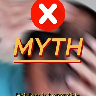 Don't fall for the #hairloss myths! It's reversible, and we can prove it - contact us today for a fr