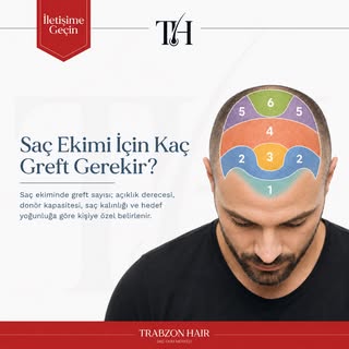 Saç ekiminde kaç greft gerektiği herkeste aynı değildir.
Açıklığın seviyesi, donör alan kapasitesi v