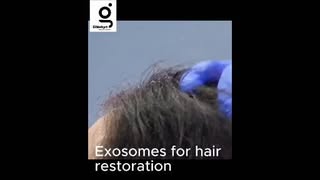 Healthy hair starts with a healthy scalp.

Exosomes are applied topically after treatment to support