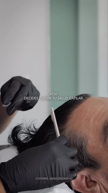 Comienza a cuidar y a prevenir la caída de tu cabello con mesoterapia capilar ✨

👩🏻‍⚕️ Dra. Karla 
