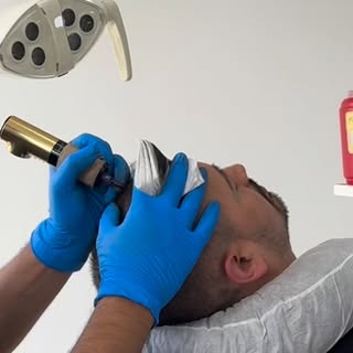 ¿Te imaginas recuperar la apariencia de tu cabello sin cirugía?

Este resultado fue realizado con mi