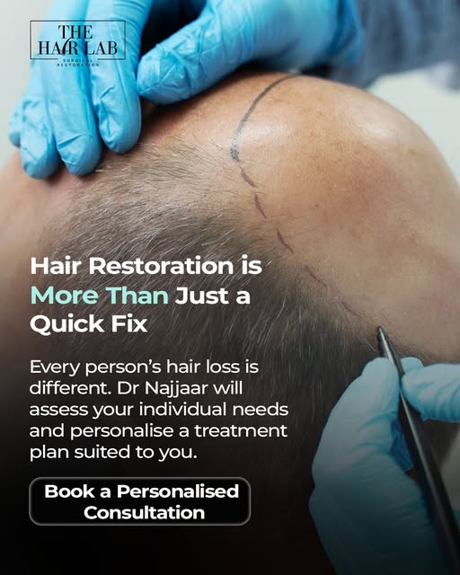 Hair restoration doesn’t begin with a standard procedure or one-size-fits-all recommendation🖊️.

Yo