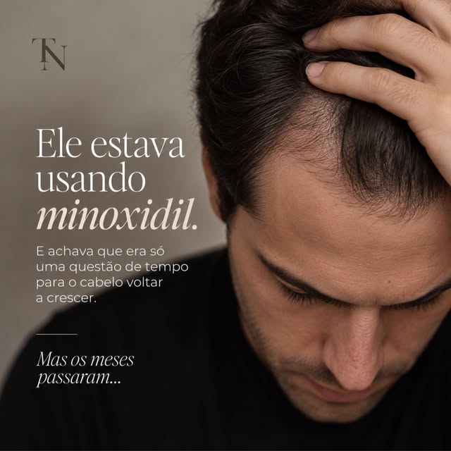 Você usa minoxidil há meses e continua esperando aquele cabelo voltar?

A pessoa começou o minoxidil