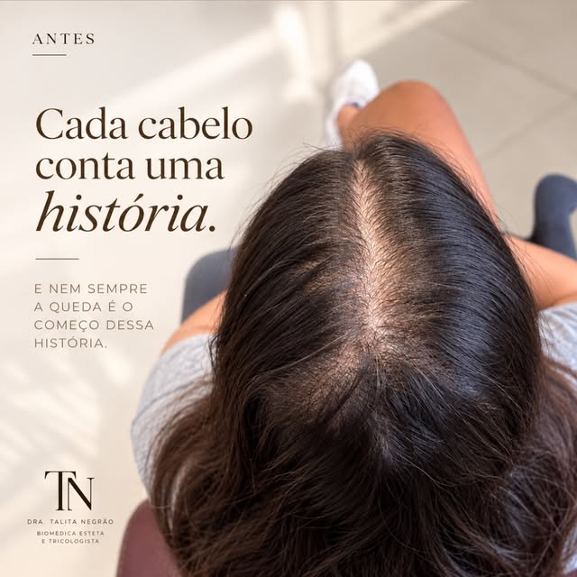 Nem todo cabelo que está afinando começa caindo muito.

Às vezes, o primeiro sinal é outro:
a risca 
