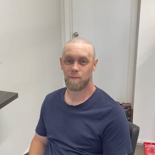 🎉 Thrilled to share the amazing transformation of our valued client, Paul! ✨ After experiencing a d