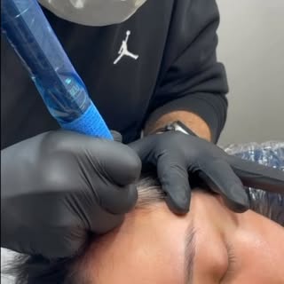 #smp #scalpmicropigmentation #density 
#hairmicropigmentation #scalp #pmu