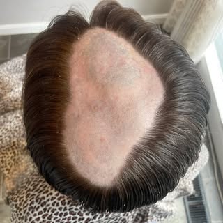 Transform your look instantly with our remarkable men’s hairpiece – embrace a flawless style with co