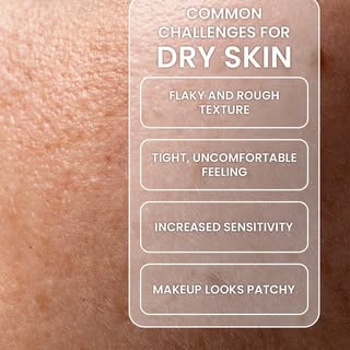 Dry skin can feel tight, rough, sensitive, and uncomfortable. It can also make makeup look patchy an