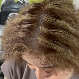 Are you a woman that struggles with thin hair? Look no further! Scalp Micropigmentation could be the