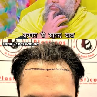 बाल नहीं, आत्मविश्वास लौटता है।
विज्ञान अपनाइए, मस्त रहिए। 

— Premanand Maharaj ji के विचारों से प्