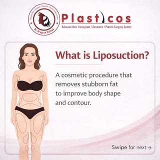 Thinking about Liposuction?

Swipe to understand what it is, how it works, its benefits, and most im