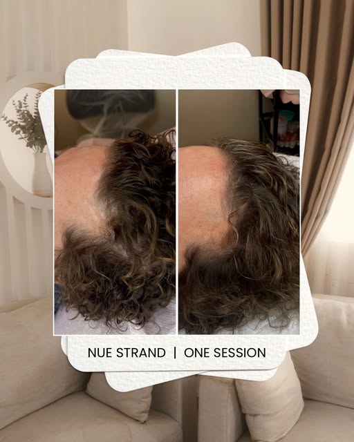 ✨ NUE STRAND EFFECT ✨
Just one session and you can already see such a significant improvement.💥

Wa