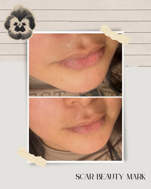 Even something so small and minuscule can make all the difference. This client requested a very natu