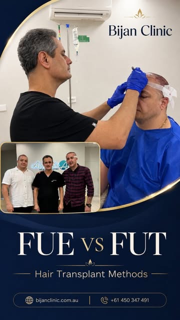FUE vs FUT — what’s the difference?
In this video, Dr Bijan explains two well-known hair transplant 