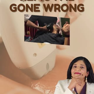 Don't fall for this Laser Hair Removal scam! 🤯 
.
.
.
.
#drsuruchipuri #laserhairemoval #dermatolog