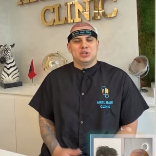 Akel Hair Clinic Siamo grati al nostro paziente brasiliano per averci scelto. ❤️
Tra 8 mesi saremo d