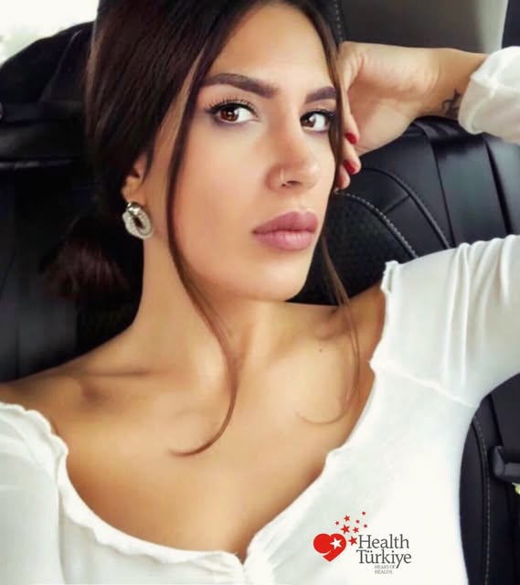 Rinoplasty, long term result.
#rinoplasty #nosejob #nosejobturkey #nasenkorrektur #rinoplasti .
. Ev
