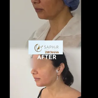 Redonnez définition et harmonie à votre profil grâce à nos solutions esthétiques personnalisées.
Une