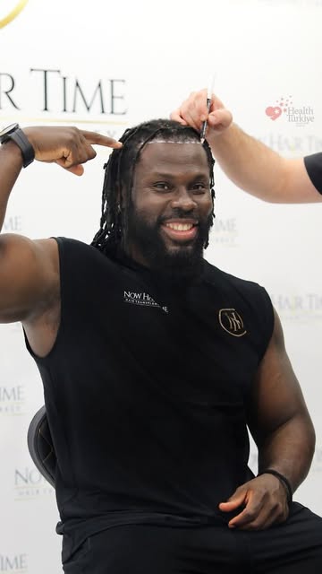 Now Hair Time | Afro Hair Transplantation✨

Afro-textured hair has distinctive structural characteri