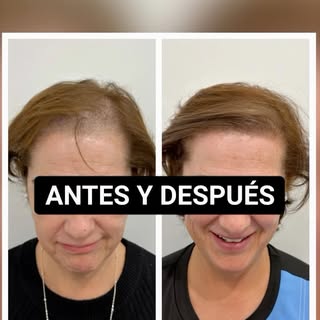 “No hay mejor publicidad que la opinión de un paciente satisfecho.”

Hoy quiero compartir el testimo
