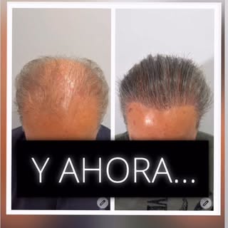 “No hay mejor publicidad que la opinión de un paciente satisfecho.”

Hoy quiero compartir el testimo