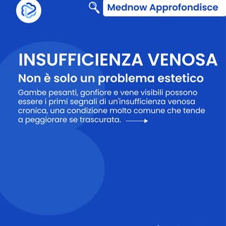 🦵 Gambe pesanti, gonfiore o vene varicose non sono solo un fastidio: potrebbero essere i primi segn