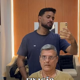 FIXAÇÃO DA PRÓTESE CAPILAR 💇🏻‍♂️

#protesecapilar #protesecapilarbrasil #protesecapilarrj #riodeja