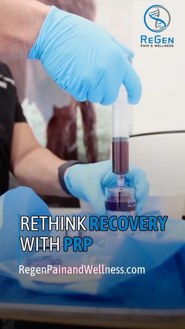 Rethink recovery with PRP.
PRP therapy uses a concentration of platelets from your own blood to supp