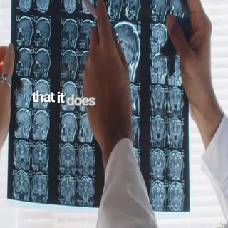 TPE isn’t a new wellness trend. Therapeutic Plasma Exchange has been used in medicine for decades.

