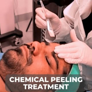 Discover the magic of chemical peeling for achieving radiant, whitened skin! 🎉 Uncover the step-by-
