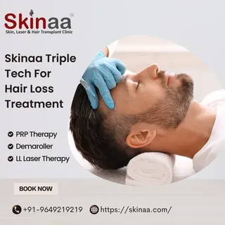 ✨ Unlock the secret to rich locks with Skinaa Tiple Tech! Say goodbye to hair loss and hello to conf