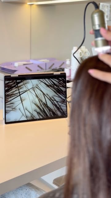Paciente: “Doutora, acho que tô com alopecia.” 

Tricologista por dentro: “Ok, mas qual das mil? 😅”