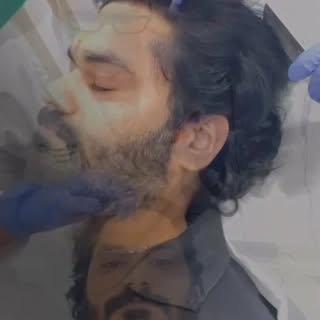 Thank’s to DR.Rahul and his team … In never seen such professional nd friendly doctor …I’m very happ