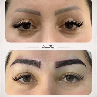 قبل و بعد، فقط یک تغییر ظاهری نیست؛ نتیجه‌ی یک انتخاب درست و اجرای دقیقِ درمانه. ✨

اگر شما هم دربار