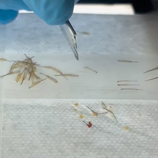 The artistry of an eyebrow transplant starts long before implantation.

Every single graft is carefu