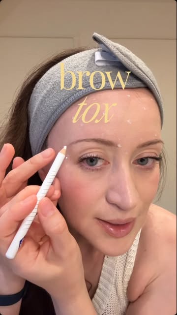 Eye opener with botulinum toxin. Applying botox on the outer and upper corner of the eye (on the tai