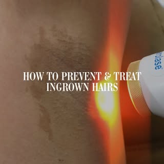 They’re not just annoying, they are a sign your skin needs a different approach.

#ingrownhairs #bou